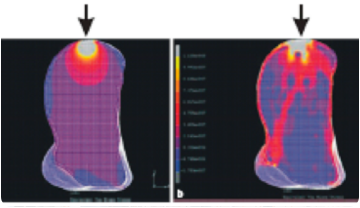 Imatge de la tomografia del canell dels hominids