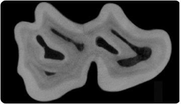 Secció transversal d'una de les dents dels micromamífers estudiats, Ruscinomys schaubi
