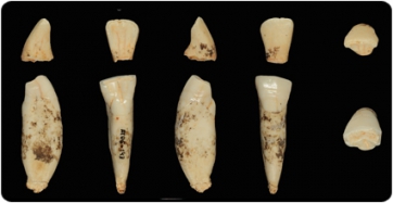 Las proteínas en el esmalte dental de Homo antecesor iluminan el camino del linaje humano