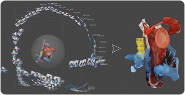 Proceso de reconstrucción de un modelo 3D, mediante fotogrametría, de una escápula humana que muestra la cavidad glenoidea con presencia del rodete glenoideo.