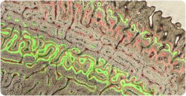 Corte histológico de un hueso largo de ciervo común. La cantidad de tejido óseo depositado en cada etapa puede cuantificarse gracias a marcadores fluorescentes. (Foto: Teresa Calderón / ICP)